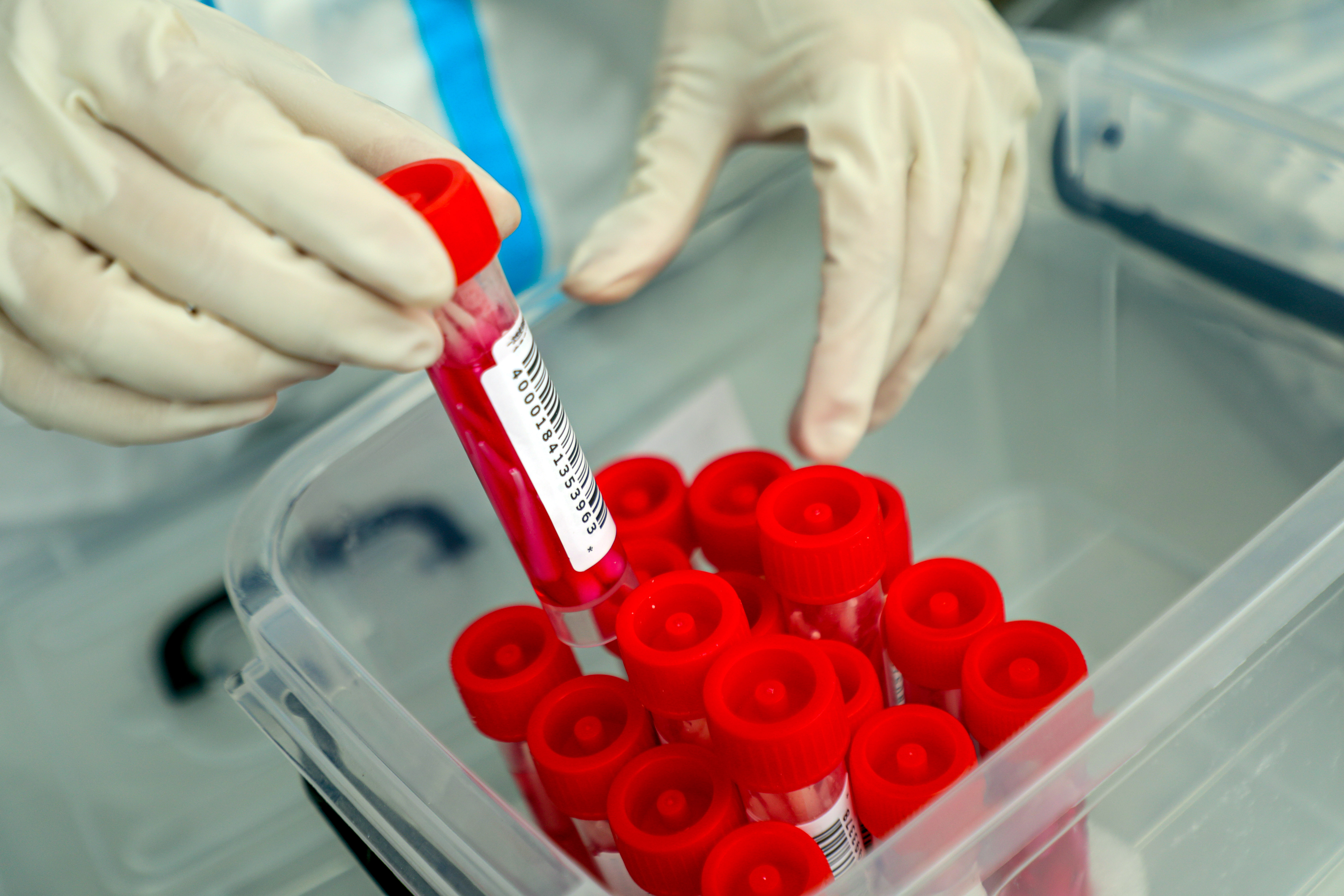 安彩高科：抗疫路上，從來都是“雙向奔赴”！